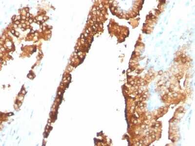 Immunohistochemistry-Paraffin: ST6 Gal Sialyltransferase 1/ST6GAL1/CD75 Antibody (ZB55) [NBP3-07770]