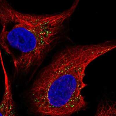 Immunocytochemistry/ Immunofluorescence: ST6 GalNAc alpha-2,6-sialyltransferaseV/ST6GALNAC5 Antibody [NBP2-56572]