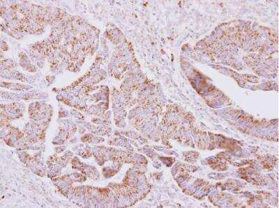 Immunohistochemistry-Paraffin: ST6 Sialyltransferase 2/ST6GALNAC2 Antibody [NBP2-20494]
