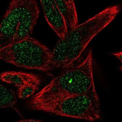 Immunocytochemistry/ Immunofluorescence: ST6 Sialyltransferase 6/ST6GALNAC6 Antibody [NBP1-80751]