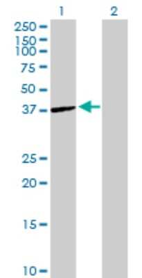 Western Blot: ST6 Sialyltransferase 6/ST6GALNAC6 Antibody [H00030815-B01P]