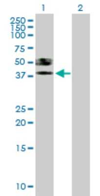 Western Blot: ST6 Sialyltransferase 6/ST6GALNAC6 Antibody [H00030815-B02P]