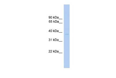 Western Blot: ST6 Sialyltransferase 6/ST6GALNAC6 Antibody [NBP3-09229]
