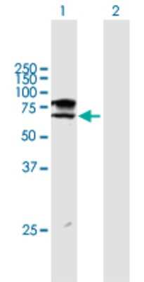 Western Blot: ST6GALNAC1 Antibody [H00055808-B01P]