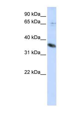 Western Blot: ST6GALNAC1 Antibody [NBP1-62649]