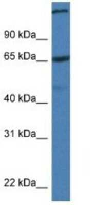 Western Blot: ST6GALNAC1 Antibody [NBP1-79210]