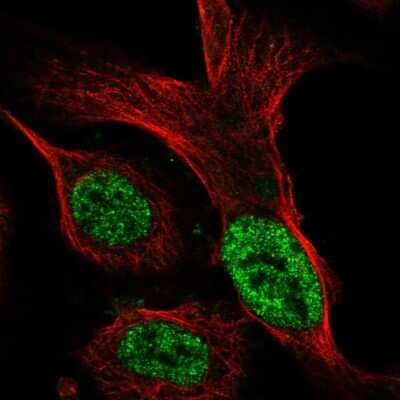 Immunocytochemistry/ Immunofluorescence: ST6GALNAC3 Antibody [NBP2-31603]