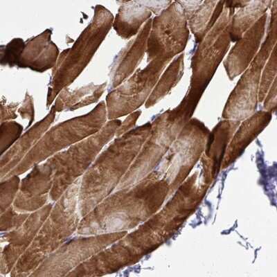 Immunohistochemistry-Paraffin: ST6GALNAC3 Antibody [NBP2-31603]