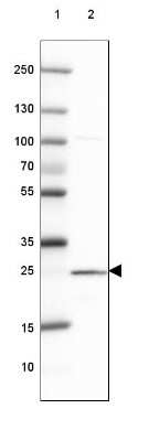 Western Blot: ST6GALNAC3 Antibody [NBP2-31603]