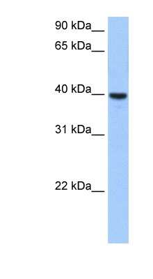 Western Blot: ST6GALNAC4 Antibody [NBP1-62417]