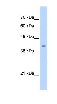 Western Blot: ST6 Sialyltransferase 6/ST6GALNAC6 Antibody [NBP1-59959]