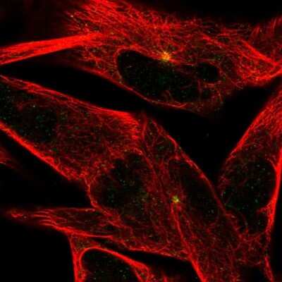 Immunocytochemistry/ Immunofluorescence: ST8 alpha-2,8-Sialyltransferase 8B/ST8SIA2 Antibody [NBP2-33719]