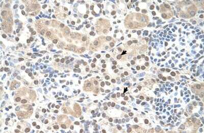Immunohistochemistry: ST8 alpha-2,8-Sialyltransferase 8B/ST8SIA2 Antibody [NBP1-69280]
