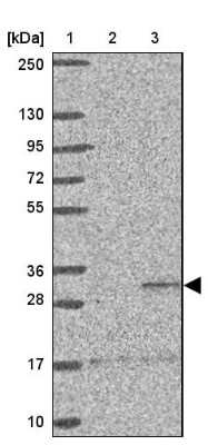Western Blot: ST8 alpha-2,8-Sialyltransferase 8B/ST8SIA2 Antibody [NBP2-33719]