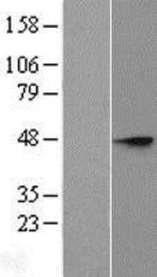 Western Blot: ST8SIA3 Overexpression Lysate [NBL1-16506]