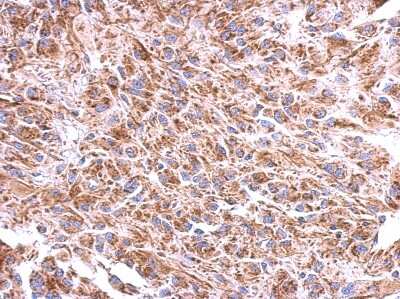 Immunohistochemistry-Paraffin: ST8 alpha-2,8-Sialyltransferase 4/ST8SIA4 Antibody [NBP2-20497]