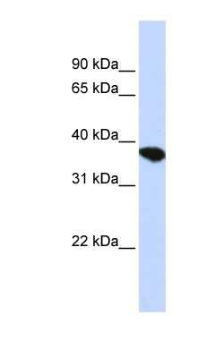 Western Blot: ST8 alpha-2,8-Sialyltransferase 4/ST8SIA4 Antibody [NBP1-79292]