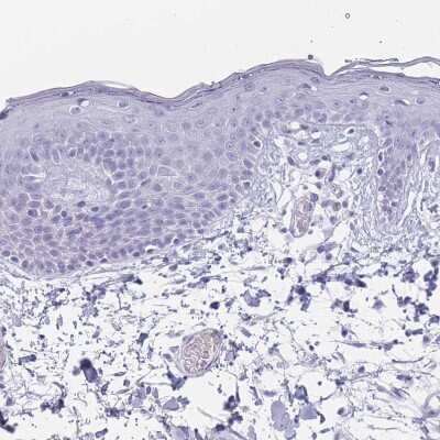 Immunohistochemistry-Paraffin: ST8SIA5 Antibody [NBP2-30530]