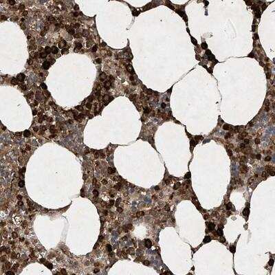 Immunohistochemistry-Paraffin: STAC Antibody [NBP1-80717]