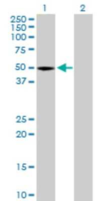 Western Blot: STAC Antibody [H00006769-B01P]