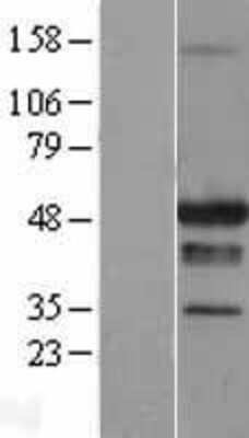 Western Blot: STAC Overexpression Lysate [NBL1-16507]