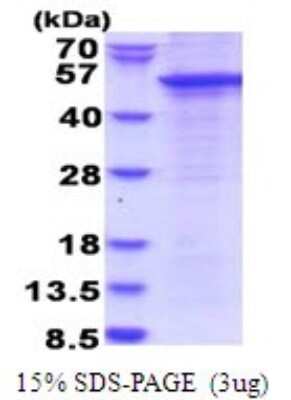 SDS-PAGE: Recombinant Human STAC His Protein [NBP2-51756]