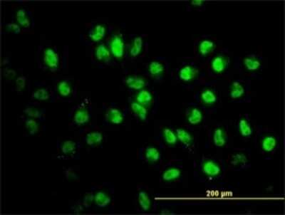 Immunocytochemistry/ Immunofluorescence: STAG2 Antibody (3C6) [H00010735-M01]