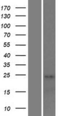 Western Blot: STAG3L1 Overexpression Lysate [NBP2-06743]