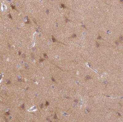 Immunohistochemistry-Paraffin: STAM-1 Antibody [NBP2-38514]