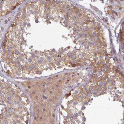 Immunohistochemistry-Paraffin: STAM-1 Antibody [NBP2-38514]