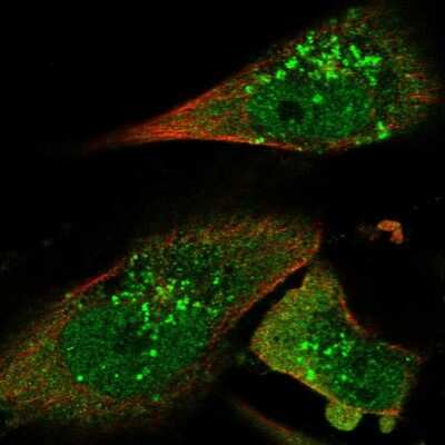 Immunocytochemistry/ Immunofluorescence: STAM2 Antibody [NBP1-83288]