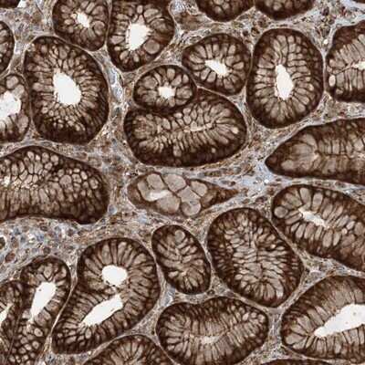 Immunohistochemistry-Paraffin: STAM2 Antibody [NBP1-83288]
