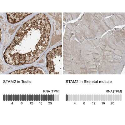Immunohistochemistry-Paraffin: STAM2 Antibody [NBP1-83289]