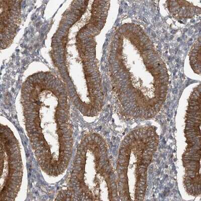 Immunohistochemistry-Paraffin: STAM2 Antibody [NBP1-83289]
