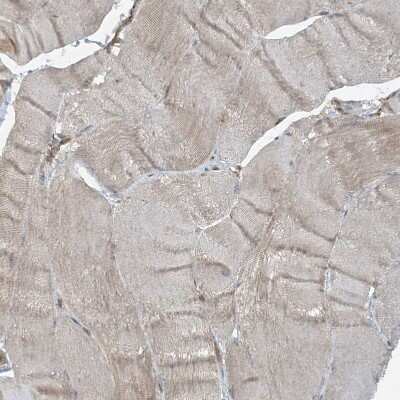 Immunohistochemistry-Paraffin: STAM2 Antibody [NBP1-83289]