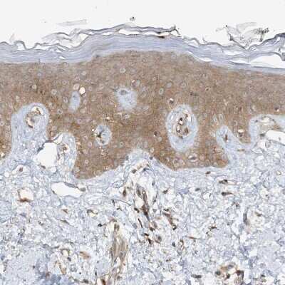 Immunohistochemistry-Paraffin: STAM2 Antibody [NBP1-83289]