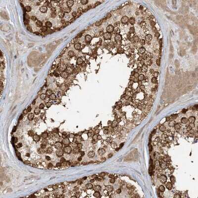 Immunohistochemistry-Paraffin: STAM2 Antibody [NBP1-83289]