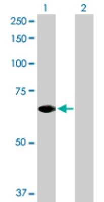 Western Blot: STAM2 Antibody [H00010254-D01P]