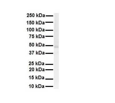 Western Blot: AMSH-LP Antibody [NBP1-56334]