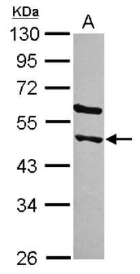 Western Blot: AMSH-LP Antibody [NBP2-20501]