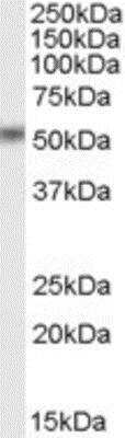 Western Blot: STAMP2/STEAP4 Antibody [NB100-68162]