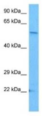 Western Blot: STAMP2/STEAP4 Antibody [NBP3-10071]