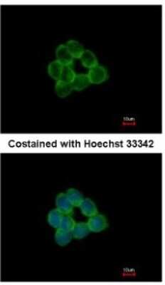 Immunocytochemistry/ Immunofluorescence: STAP2 Antibody [NBP1-33643]