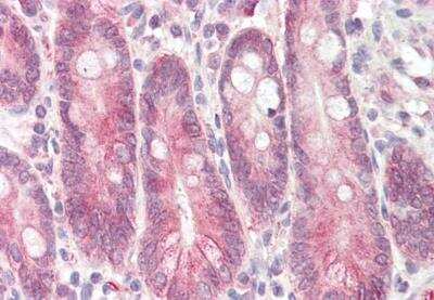 Immunohistochemistry-Paraffin: STAP2 Antibody [NBP1-51904]