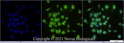 Immunocytochemistry/ Immunofluorescence: STARD10 Antibody - BSA Free [NBP2-78818]