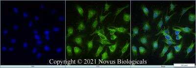 Immunocytochemistry/ Immunofluorescence: STARD10 Antibody - BSA Free [NBP2-78818]