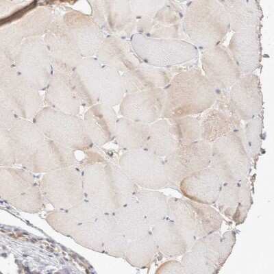 Immunohistochemistry-Paraffin: STARD10 Antibody [NBP1-84508]