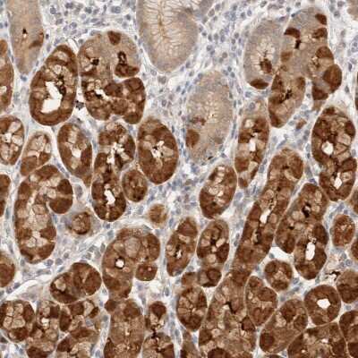 Immunohistochemistry-Paraffin: STARD10 Antibody [NBP1-84508]