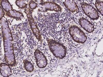 Immunohistochemistry-Paraffin: STARD10 Antibody [NBP2-98108]