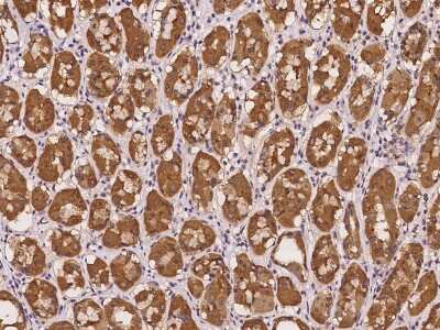 Immunohistochemistry-Paraffin: STARD10 Antibody [NBP2-98108]